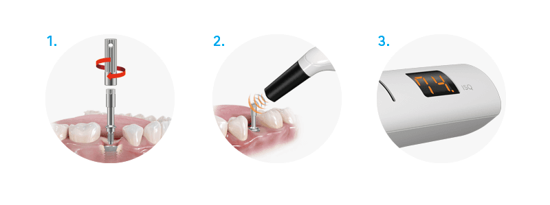 Sonda MulTipeg™ NSK (reutilizable)