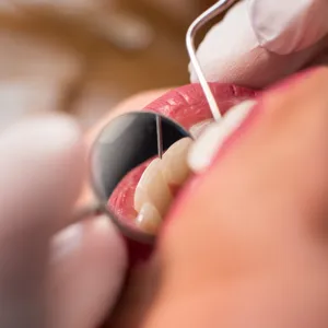 Endodoncia